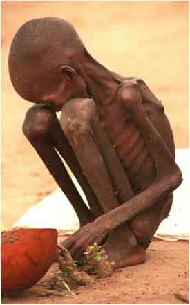 Enfant affamé du Sudan