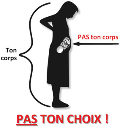 Pas ton corps, pas ton choix